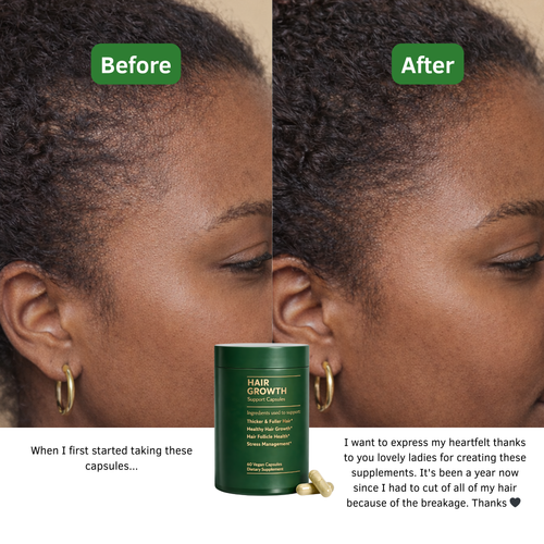 Hair Growth Support